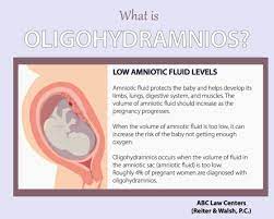 What Is Oligohydramnios? (Signs And Symptoms)