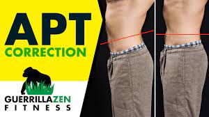 Anterior Pelvic Tilt Before And After Youtube