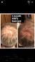 Before And After Wow Shampoo