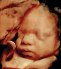 TEXAS CHILDREN'S FETAL CENTER™ OUTCOMES