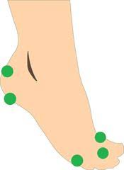 Depending on the affected nerves, diabetic neuropathy symptoms can range from pain and numbness in your legs and feet to problems with your. Bursitis Foot Pain Treatment The Best Ways To Get Relief
