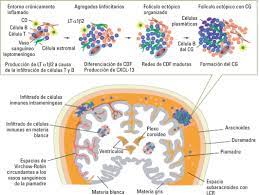 Learn about caring for and parenting multiples. Esclerosis Multiple Sciencedirect
