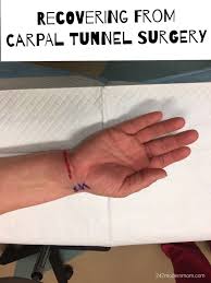 Carpal Tunnel Surgery Recovery 3 Months Later 24 7 Modern Mom Life Solutions For Parents Of Children With Special Needs Carpal Tunnel Surgery Carpal Tunnel Surgery Recovery Carpal Tunnel