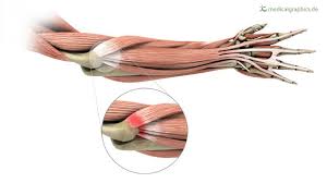 Tenniselbowmanagement a multimodal management programme for. How To Treat Tennis Elbow ð—£ ð—¥ð—²ð—µð—®ð—¯