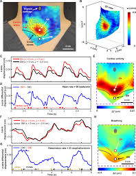 Top bathroom paint colors for 2020 trends and fads ppt. Differential Cardiopulmonary Monitoring System For Artifact Canceled Physiological Tracking Of Athletes Workers And Covid 19 Patients Science Advances