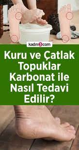 tursular panosundaki pin