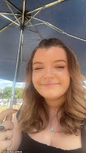 Woman reveals how her face DOUBLED in size due to sun poisoning