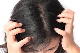 Keep your scalp clean and choose your shampoos wisely. Home Remedies For Dry Scalp What Works Best And Why Top 10 Home Remedies