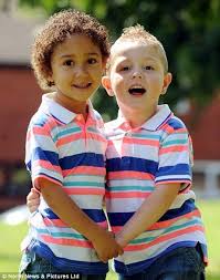 Black And White Identical Twins Pin On Interesting People