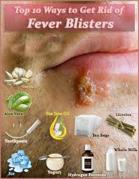 Home Green Yatra Blog Cold Sores Remedies Fever Blister Blister Remedies