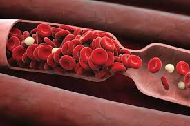 Thrombosis usually begins as an inflammation of the vein known as phlebitis *. Other Drugs That Can Also Cause Thrombosis