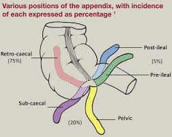 Lab testing and imaging are important for the official diagnosis of appendicitis. Acute Appendicitis Surgery Oxford International Edition
