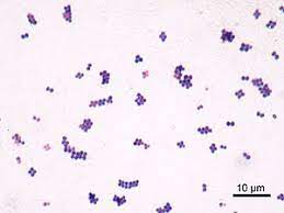 It gets its name from the danish bacteriologist hans christian gram who first introduced it in 1882, mainly to identify organisms causing pneumonia.1 often the first test performed, gram staining involves the use of crystal violet or methylene blue as the primary color.2 the term for organisms that retain the. Coccus Wikipedia