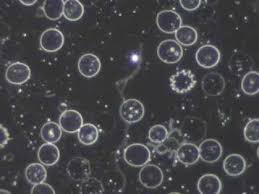 Resultado de imagen para MICROSCOPIA DE CAMPO OSCURO