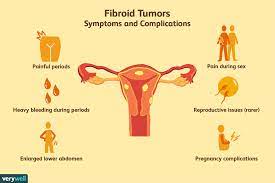 These fibroids are made up of groups of muscle cells and other tissues, and can range in size from as small as a pea to as large as 5 to 6 inches (12.7 to 15.24 centimeters) wide. Uterine Fibroid Tumors Symptoms Causes Diagnosis And Treatment