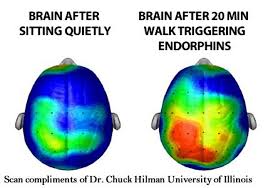 Related online courses on physioplus. How Brain Imaging Helps Explain Social Anxiety Disorder