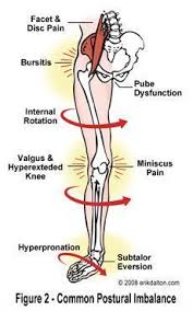 Pin On Knee Pain