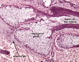 Image result for Sebaceous Gland