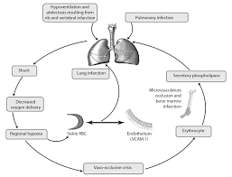 Sickle Cell Emergencies 2018 05 07 Ahc Media Continuing Medical Education Publishing