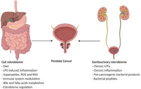 The pancreas is located behind the stomach, so having pancreatic cancer doesn't involve a palpable mass that you can feel. The Human Microbiome And Its Link In Prostate Cancer Risk And Pathogenesis Infectious Agents And Cancer Full Text