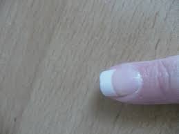 Zum aufdrücken der nagelfolien eignet sich auch ein hufstäbchen besonders gut. Hilfe Nagel Total Kaputt Total Peinlich