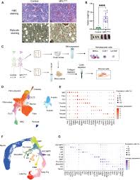 A proinflammatory stem cell niche drives myelofibrosis through a targetable  galectin-1 axis | Science Translational Medicine
