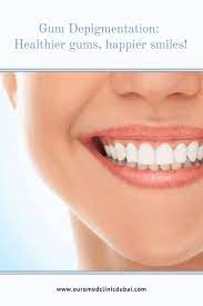 Pin On Cosmetics Dentistry