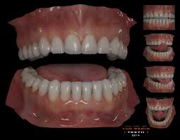 Generic Teeths Luc Begin Teeth Anatomy Zbrush Anatomy Zbrush