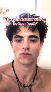 He Smiled with His Bottom Teeth: A Unique Encounter