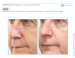 6000 northern pass (1,262.70 mi) el paso, tx, tx 79911. Laser El Paso Tx Las Cruces Nm Southwest Plastic Surgery