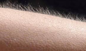 What Causes Goose Bumps Kids Discover What does goosebumps expression mean? what causes goose bumps kids discover