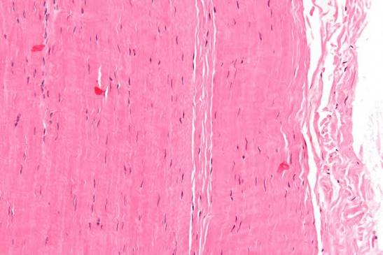 Tendon - Wikipedia