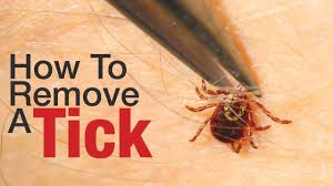 Check spelling or type a new query. How To Remove A Tick Youtube