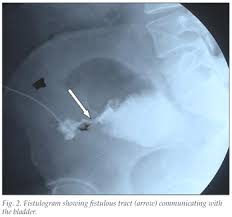 Image result for Umbilicus botryoides
