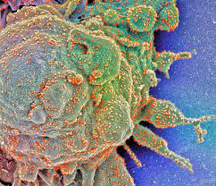 It will soon be the dominant form in. Cdc Delta Variant Now 10 Of Us Covid 19 Cases Cidrap