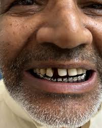 Photos by Ira Tripathi (@tripathidental) · August 12, 2024