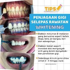 We did not find results for: Ramai Yang Tahu Tentang Whitening Klinik Pergigian Dr Smile Facebook