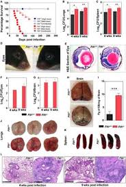 When it comes to furniture, a lot of people end up settling for something other than what they wanted because of the cost involved. Frontiers Ferritin H Deficiency In Myeloid Compartments Dysregulates Host Energy Metabolism And Increases Susceptibility To Mycobacterium Tuberculosis Infection Immunology