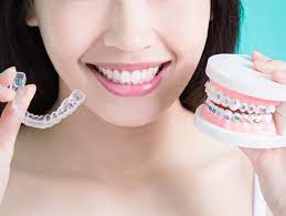 The metallic braces look weird on teeth and a person cannot remove them. Profile Orthodonticsare There Fees For Broken Brackets Wires Plates Or Lost Aligners