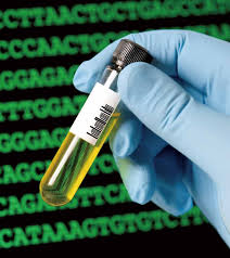 慎防結核病捲土重來長壽從平衡中來丟掉迷思拒做憤老中醫療法的一 ...