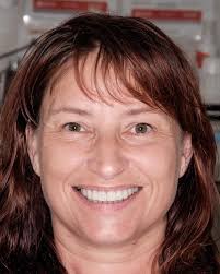 Smile Gallery & Case Studies