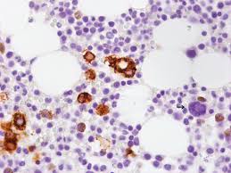 Remember that blood cells include. Scientific Image Gallery