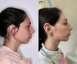 🌟 ¡Hola a todos! 🌟 Queremos presentarles al licenciado que nos acompaña  en el área de Psicología desde hace un tiempo. El es: 👨‍⚕️ **Licenciado  Mariano Pennisi** Estamos muy agradecidos por su