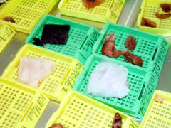 Hematoksilen Eozin Patoloji Gen Tr