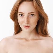 Image result for Freckled skin