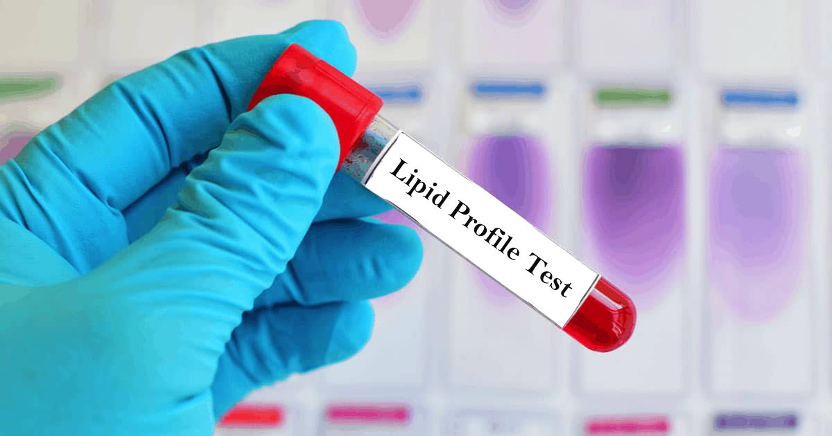 LIPID PRO product image