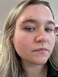 Surviving domestic abuse with a concussion