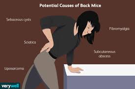 This muscle assists with the external rotation of the hip. Back Mice Symptoms And Diagnosis