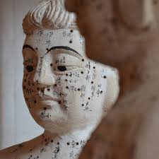 Acupuncture Treatment