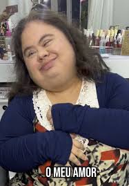 Sindrome De Down En Concierto Mirando Chicas